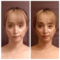 画像1381：施術事例