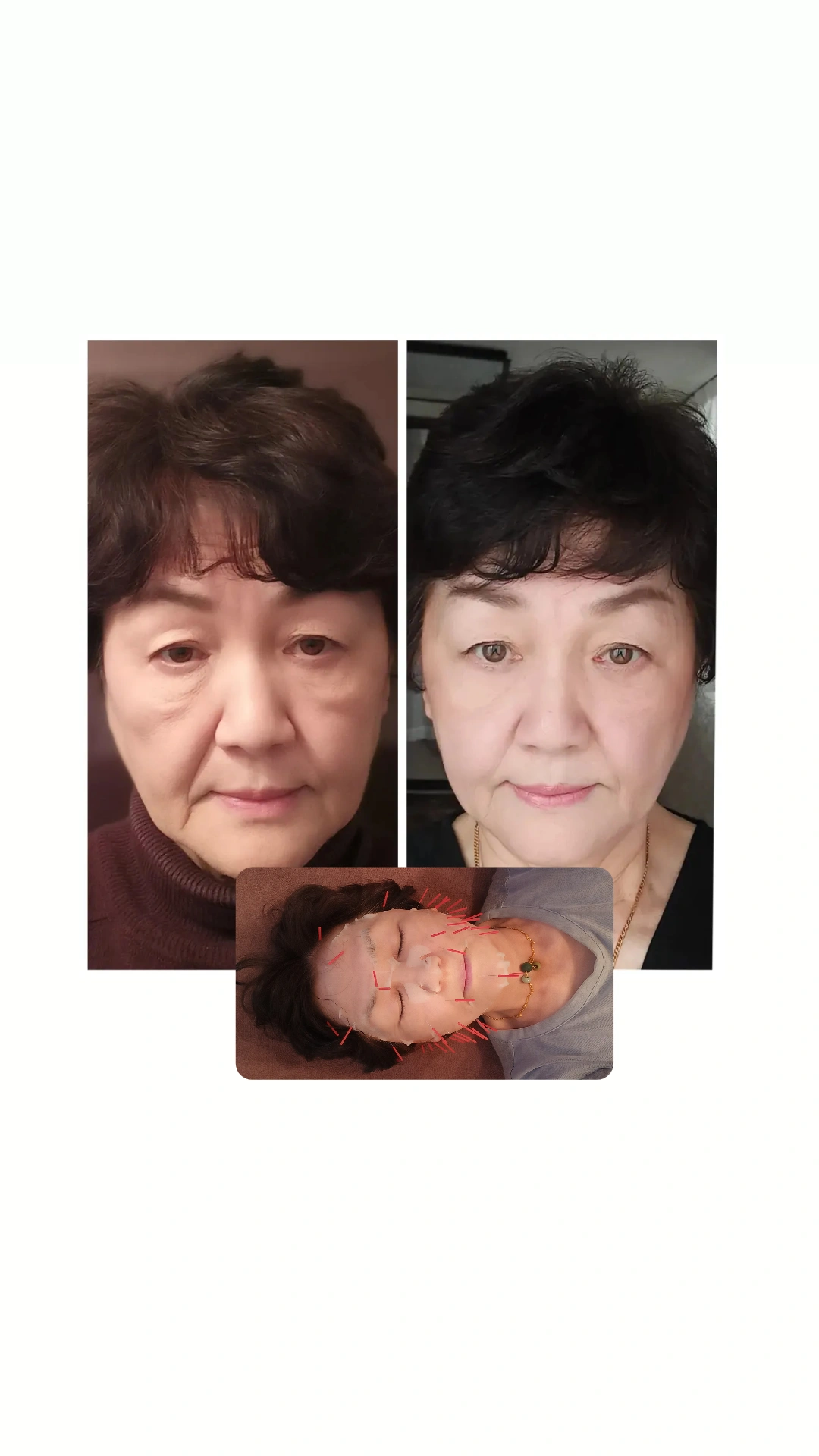 画像1455：施術事例