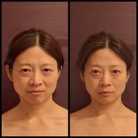 画像5194：施術事例