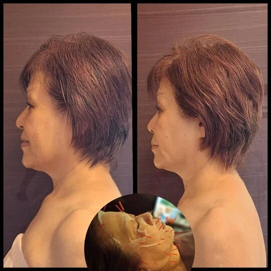 画像5196：施術事例