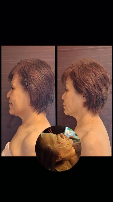 画像5196：施術事例
